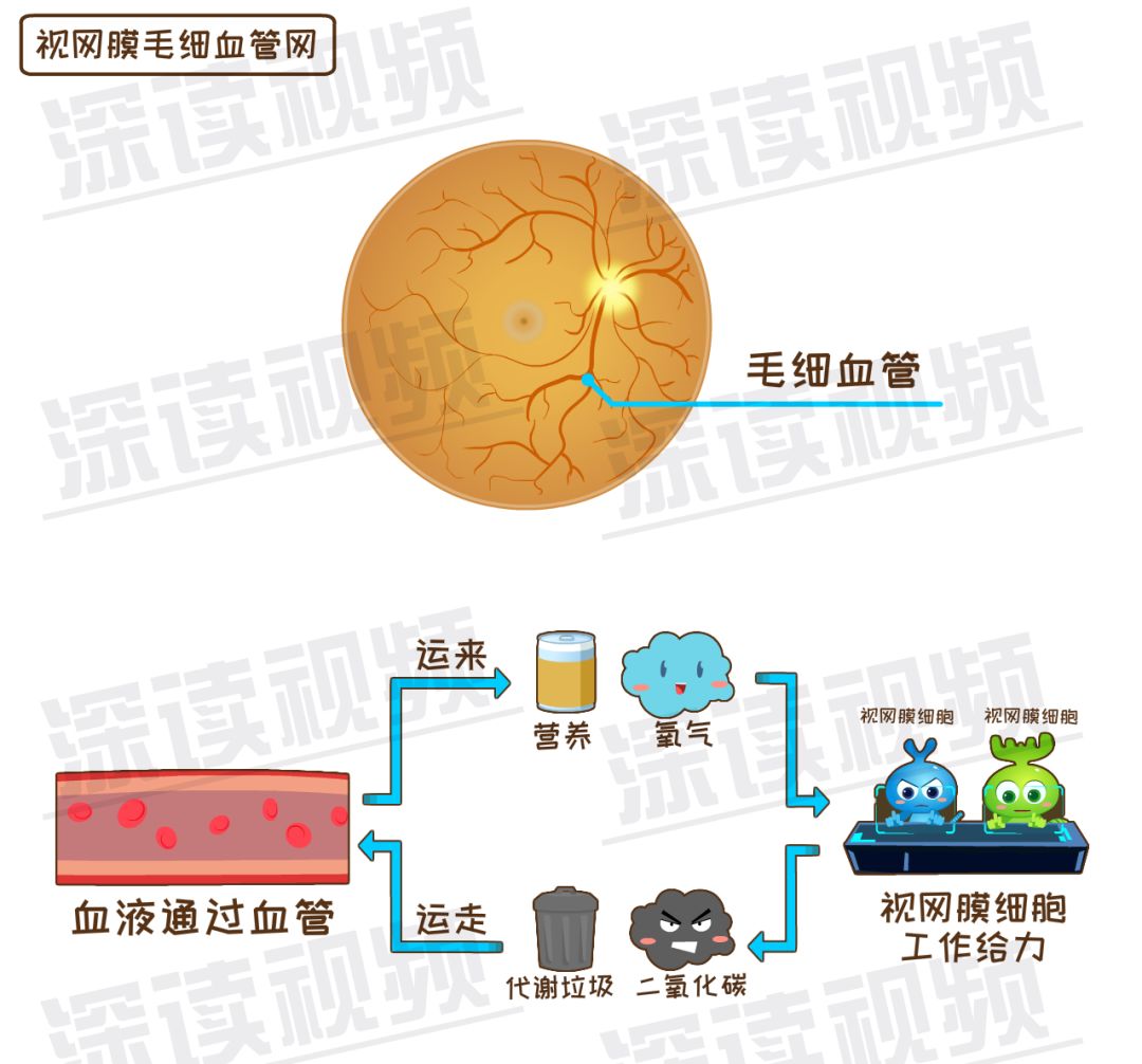 糖友控糖不利，视网膜会脱落？不痛不痒就瞎了？动漫解析致盲细节