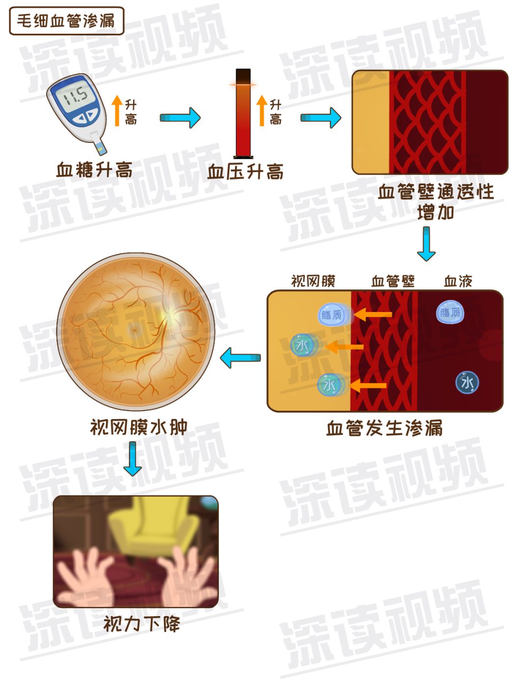 糖友控糖不利，视网膜会脱落？不痛不痒就瞎了？动漫解析致盲细节